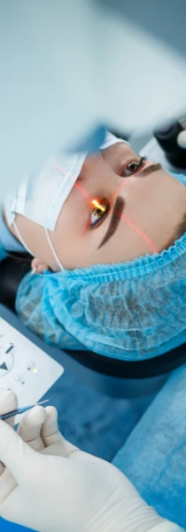 LASIK procedure